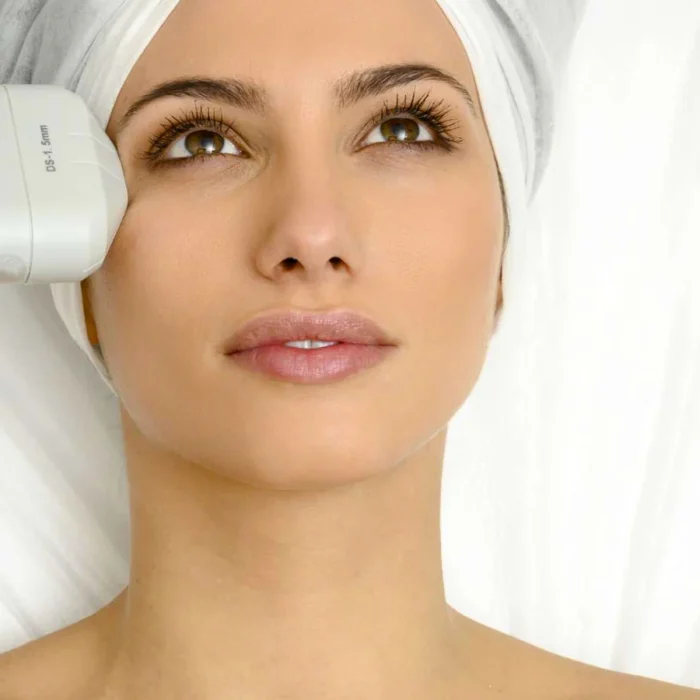 LIFTING SIN CIRUGÍA HIFU FACIAL